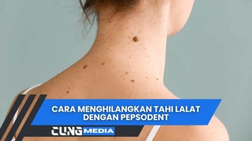 Cara Menghilangkan Tahi Lalat Dengan Pepsodent