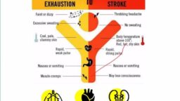 Perempuan Alami Heatstroke Usai Sauna 45 Menit, Ini Penyebabnya!